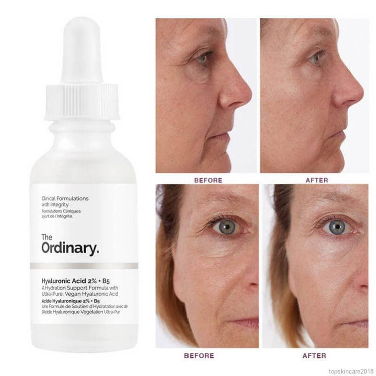 سرم هیالورونیک اسید 2% +B5 اوردینری The Ordinary